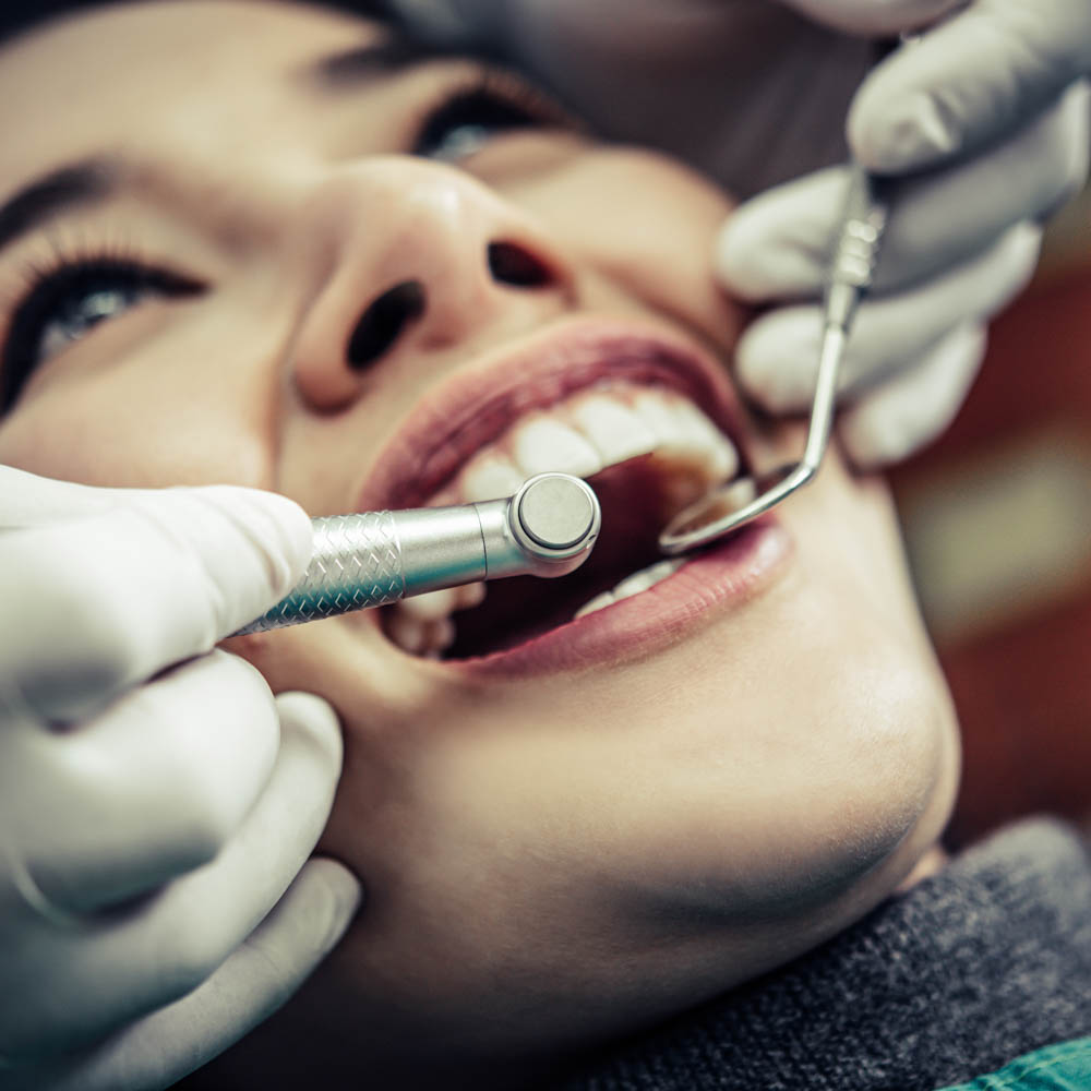 Chirurgia rigenerativa dentista segrate milano