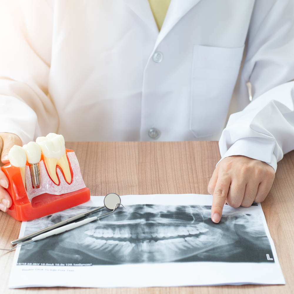 odontoiatria conservativa e endodonzia dentista segrate milano
