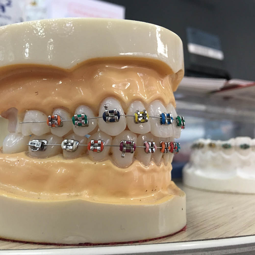 ortodonzia dentista segrate milano