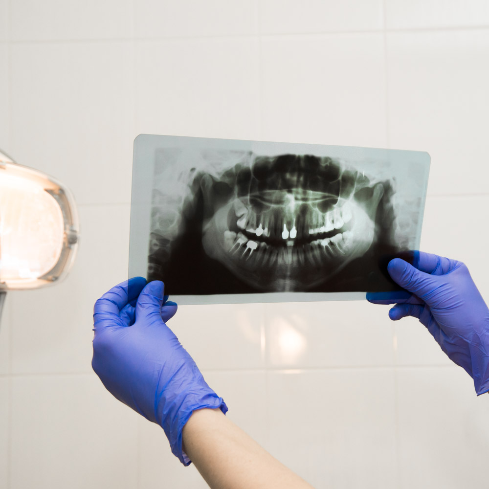 radiodiagnostica dentista segrate milano