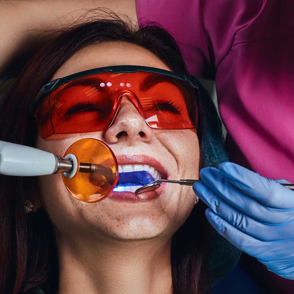 sbiancamento dentale dentista segrate milano